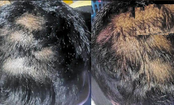 கம்பளை பாடசாலை ஒன்றின் 17 மாணவர்களின் தலைமுடி வெட்டப்பட்டமை தொடர்பில் விசாரணை!