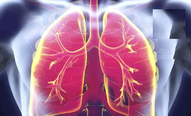 காசநோய் இனம்காணப்படாத பலர் பொதுவெளியில்….! வைத்தியர் சந்திரகுமார் எச்சரிக்கை….!