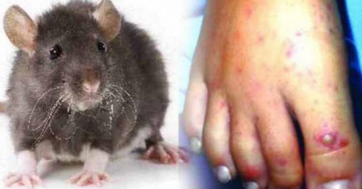 எலிக்காய்ச்சலினால் பாதிக்கப்பட்டவர்களின் எண்ணிக்கையில் அதிகரிப்பு!