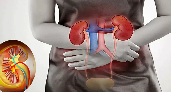 சிறுநீரக நோயாளர்களின் எண்ணிக்கை அதிகரிக்க கூடும் என எச்சரிக்கை!