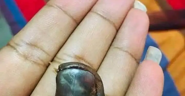 சொக்லெட்டுக்குள் இருந்த விரல்