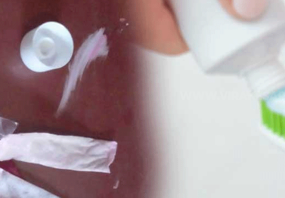 கைதிக்குச் சூட்சுமமான முறையில் போதைப்பொருள் கொண்டு சென்றவர் கைது!