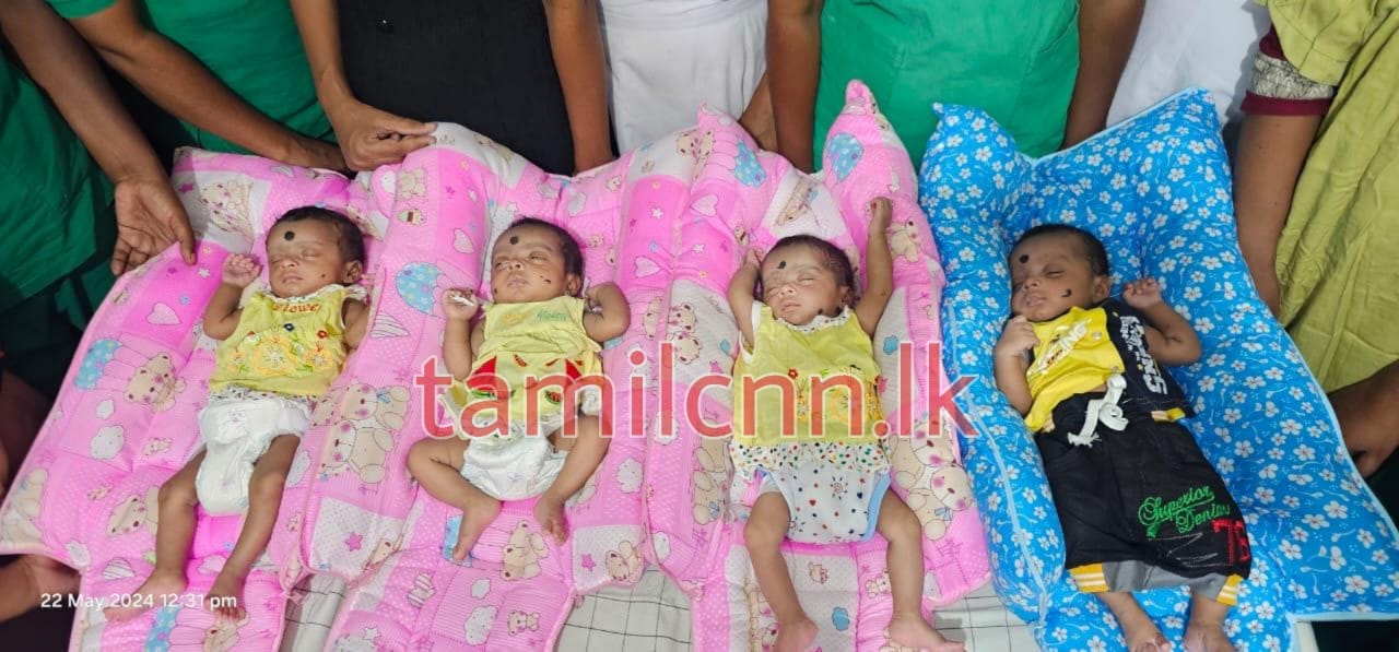 மட்டக்களப்பில் 4 குழந்தைகளை பிரசவித்த தாய்