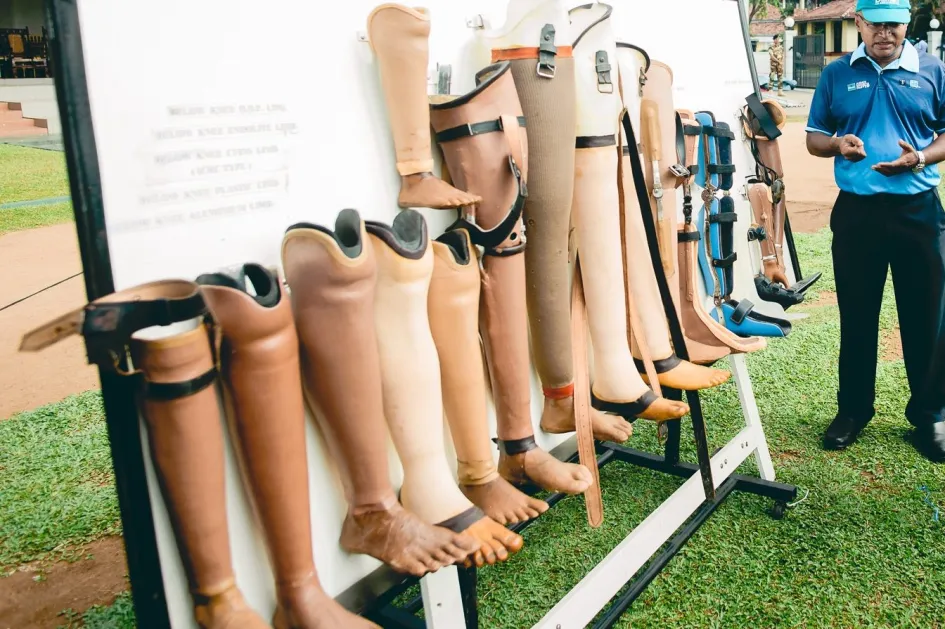 செயற்கை கால்,கைகள் தயாரிக்கும் திட்டம் இலங்கையில் ஆரம்பம்